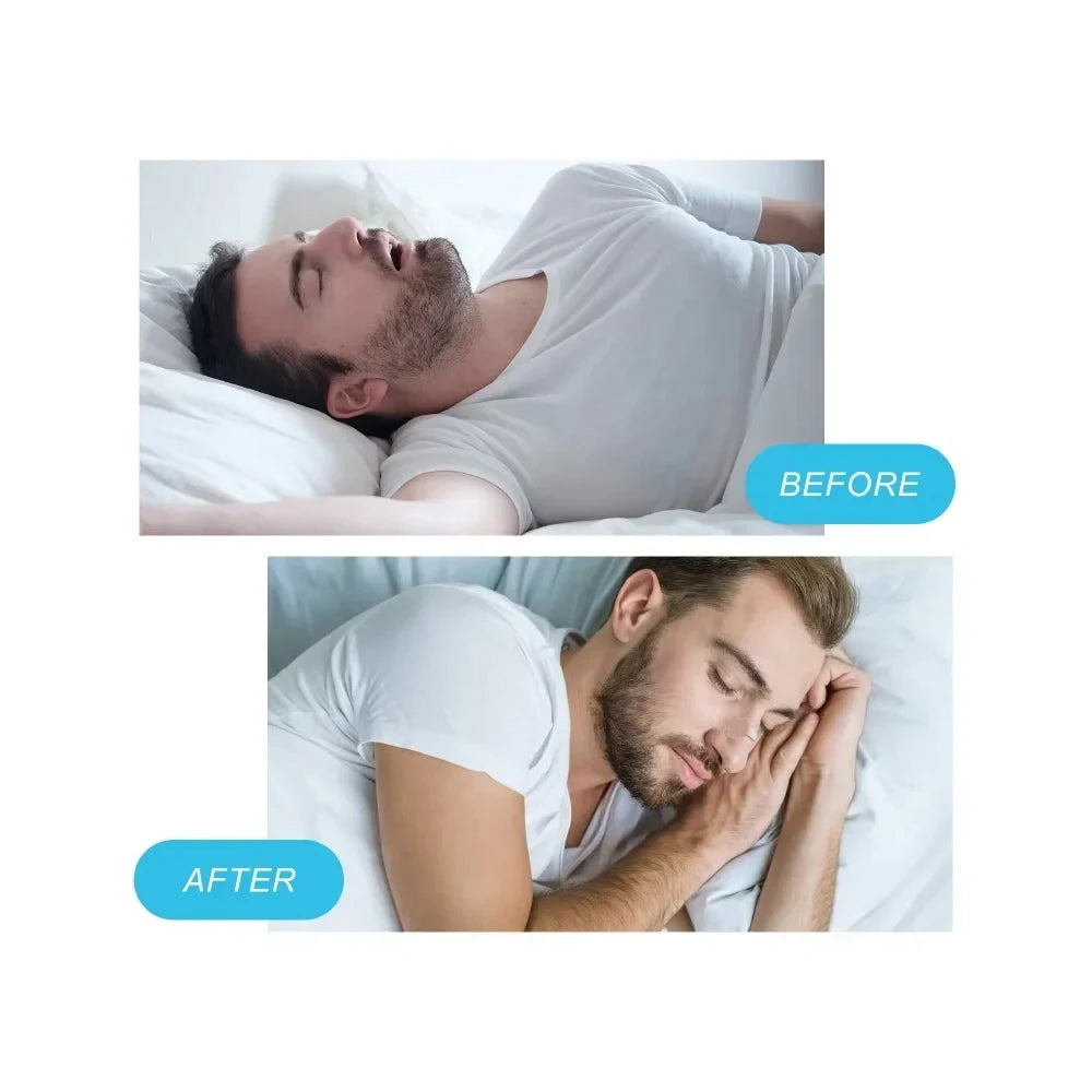 Breathe Easy™ Nasal Dilator Kit